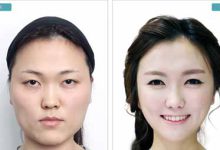 عمل های زیبایی