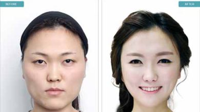 عمل های زیبایی