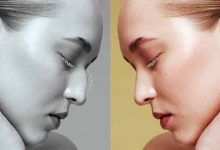 عمل ترمیم بینی