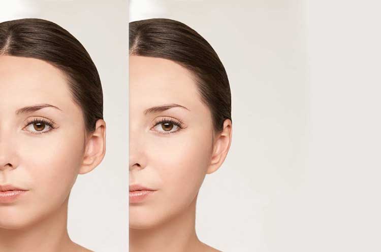 جراحی زیبایی گوش