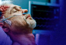 مدت زمان بیهوشی بعد از عمل خونریزی مغزی با چند حقیقت جالب