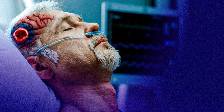 مدت زمان بیهوشی بعد از عمل خونریزی مغزی با چند حقیقت جالب